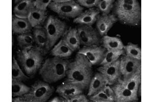 Immunofluorescent staining of A549 (ATCC CCL-185) cells. (GNB2L1 Antikörper  (AA 113-317))
