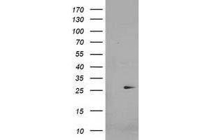 HEK293T cells were transfected with the pCMV6-ENTRY control (Left lane) or pCMV6-ENTRY CDKN3 (Right lane) cDNA for 48 hrs and lysed. (CDKN3 Antikörper)