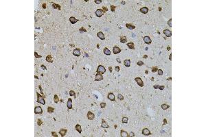 Immunohistochemistry of paraffin-embedded mouse brain using IRF1 antibody. (IRF1 Antikörper)