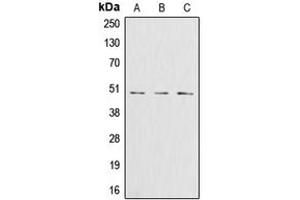 Western blot analysis of Glutamine Synthetase expression in Jurkat (A), HeLa (B), HT29 (C) whole cell lysates.