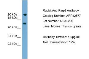 WB Suggested Anti-Parp8 Antibody Titration:  0. (PARP8 Antikörper  (C-Term))