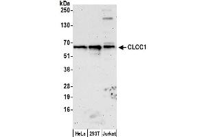 anti-Chloride Channel CLIC-Like 1 (CLCC1) (AA 425-475) antibody