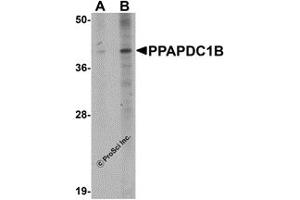 Western Blotting (WB) image for anti-Phosphatidic Acid Phosphatase Type 2 Domain Containing 1B (PPAPDC1B) (N-Term) antibody (ABIN1031523) (PPAPDC1B Antikörper  (N-Term))
