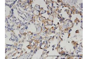Image no. 1 for anti-Glutaminyl-Peptide Cyclotransferase (QPCT) (AA 262-360) antibody (ABIN599543) (QPCT Antikörper  (AA 262-360))