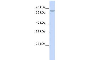 WB Suggested Anti-ASH2L Antibody Titration: 0. (ASH2L Antikörper  (N-Term))