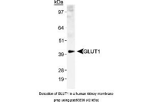 Image no. 2 for anti-Solute Carrier Family 2 (Facilitated Glucose Transporter), Member 1 (SLC2A1) (AA 1-100), (N-Term) antibody (ABIN363548) (GLUT1 Antikörper  (N-Term))
