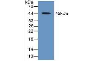 Detection of Recombinant ACAT2, Human using Polyclonal Antibody to Acetyl Coenzyme A Acetyltransferase 2 (ACAT2) (ACAT2 Antikörper  (AA 1-397))
