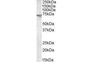 Western Blotting (WB) image for Acetylcholinesterase (AChE) peptide (ABIN370349) (Acetylcholinesterase (AChE) Peptid)