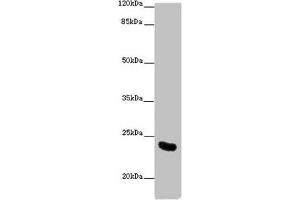 Western blot All lanes: AICDA antibody at 10 μg/mL + Mouse liver tissue Secondary Goat polyclonal to rabbit IgG at 1/10000 dilution Predicted band size: 24, 23 kDa Observed band size: 24 kDa (AICDA Antikörper  (AA 1-60))