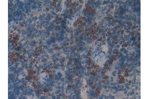 Immunohistochemistry (IHC) image for anti-Myeloperoxidase (MPO) (AA 134-263) antibody (ABIN7429595)