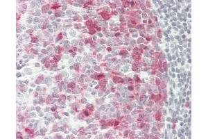 Human Tonsil: Formalin-Fixed, Paraffin-Embedded (FFPE)