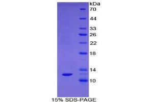 SDS-PAGE (SDS) image for Somatostatin (SST) (AA 27-116) protein (His tag) (ABIN1878285)