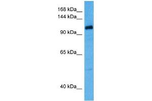 Host:  Rabbit  Target Name:  KCNQ5  Sample Tissue:  Human OVCAR-3 Whole Cell lysates  Antibody Dilution:  1ug/ml (KCNQ5 Antikörper  (C-Term))
