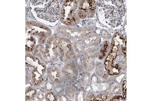 Immunohistochemical staining of human kidney with HEATR6 polyclonal antibody  shows strong cytoplasmic positivity in a subset of tubules. (HEATR6 Antikörper)