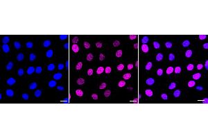 anti-Sirtuin 6 (SIRT6) antibody