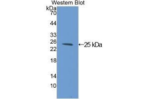 Western blot analysis of the recombinant protein. (C1QBP Antikörper  (AA 72-279))