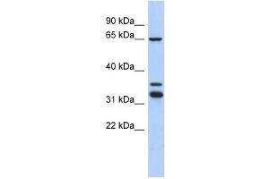 S100PBP antibody used at 1 ug/ml to detect target protein.