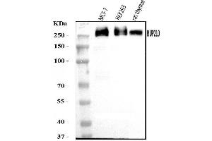 Western blot analysis of GP210/NUP210 using anti-GP210/NUP210 antibody (ABIN7600707). (NUP210 Antikörper  (AA 221-1724))
