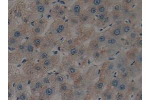 Detection of tPA in Human Liver Tissue using Polyclonal Antibody to Tissue Plasminogen Activator (tPA) (PLAT Antikörper)