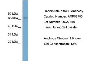 Western Blotting (WB) image for anti-Protein Kinase C, eta (PRKCH) (N-Term) antibody (ABIN2786852)