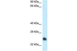 Image no. 1 for anti-Calcium Binding tyrosine-(Y)-phosphorylation Regulated (CABYR) (AA 93-142) antibody (ABIN6747985) (CABYR Antikörper  (AA 93-142))