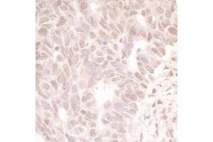 anti-Microtubule Associated serine/threonine Kinase-Like (MASTL) (AA 550-600) antibody