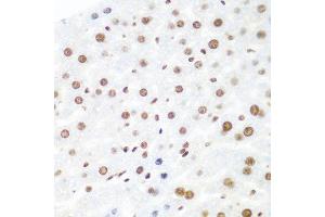 Immunohistochemistry of paraffin-embedded mouse liver using AGO2 antibody at dilution of 1:100 (40x lens). (AGO2 Antikörper)