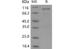 Western Blotting (WB) image for Sema Domain, Immunoglobulin Domain (Ig), Short Basic Domain, Secreted, (Semaphorin) 3A (SEMA3A) protein (Fc Tag) (ABIN7320211) (SEMA3A Protein (Fc Tag))