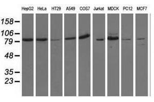 Image no. 2 for anti-Oxysterol Binding Protein-Like 11 (OSBPL11) antibody (ABIN1499923)