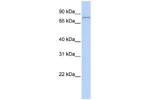 WB Suggested Anti-HDAC9 Antibody Titration:  0. (HDAC9 Antikörper  (Middle Region))