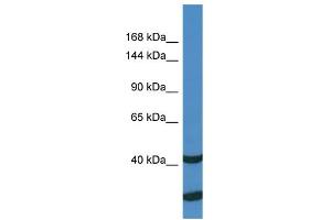 Host:  Rabbit  Target Name:  UBE3C  Sample Type:  THP-1 whole cell lysates  Antibody Dilution:  1. (UBE3C Antikörper  (N-Term))