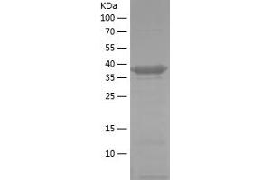 Western Blotting (WB) image for phosphofructokinase, Platelet (PFKP) (AA 436-784) protein (His tag) (ABIN7124409) (PFKP Protein (AA 436-784) (His tag))