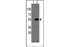 Image no. 1 for anti-Nuclear Receptor Subfamily 0, Group B, Member 1 (NR0B1) (N-Term) antibody (ABIN357833) (NR0B1 Antikörper  (N-Term))