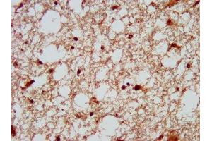 IHC image of ABIN7150649 diluted at 1:200 and staining in paraffin-embedded human brain tissue performed on a Leica BondTM system. (DSCAM Antikörper  (AA 1711-1867))