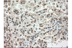Immunohistochemical staining of paraffin-embedded liver tissue using anti-SERPINA1mouse monoclonal antibody. (SERPINA1 Antikörper)