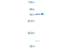 ZNF101 Protein (AA 1-316) (GST tag)