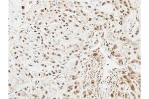 Immunohistochemistry (IHC) image for anti-Ubiquitin-Conjugating Enzyme E2L 3 (UBE2L3) (C-Term) antibody (ABIN2855918)