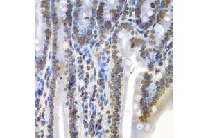 Immunohistochemistry of paraffin-embedded mouse Intestine using SEPT7 antibody (ABIN5971967) at dilution of 1/100 (40x lens). (Septin 7 Antikörper)