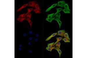 Phospho-Mitofusin 2 (Ser442) Antibody staining Hela cells(heat shock treatment) by IF/ICC.