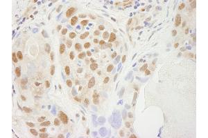 Immunohistochemistry (IHC) image for anti-Transcription Elongation Factor SPT5 (SUPT5H) (C-Term) antibody (ABIN7448819) (SUPT5H Antikörper  (C-Term))