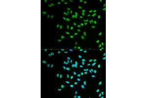 Immunofluorescence analysis of MCF-7 cells using FANCD2 antibody. (FANCD2 Antikörper  (AA 1-230))