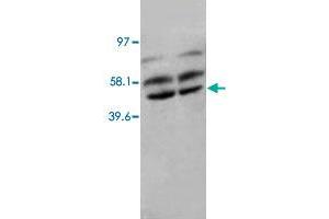 Western Blot analysis of PPP2CA expression from rat kidney tissue lyate with PPP2CA polyclonal antibody .