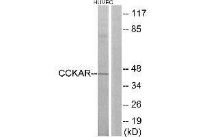 Western blot analysis of extracts from HUVEC cells, using CCKAR antibody. (CCKAR Antikörper  (Internal Region))