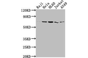 Western Blot Positive WB detected in: Raji whole cell lysate, Hela whole cell lysate, HL60 whole cell lysate, Jurkat whole cell lysate, A549 whole cell lysate All lanes: PRMT5 antibody at 1:2000 Secondary Goat polyclonal to rabbit IgG at 1/50000 dilution Predicted band size: 73, 72, 54, 68, 67 kDa Observed band size: 73 kDa