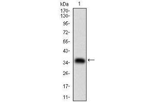 Western blot analysis using ABCB1 mAb against human ABCB1 (AA: 632-693) recombinant protein. (ABCB1 Antikörper  (AA 632-693))