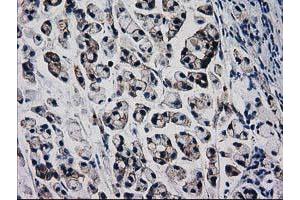 Image no. 3 for anti-Catenin (Cadherin-Associated Protein), beta 1, 88kDa (CTNNB1) antibody (ABIN1496890) (CTNNB1 Antikörper)