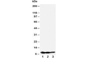 Western blot testing of BAFF-R antibody and Lane 1:  recombinant human protein 10ng;  2: 5ng;  3: 2.