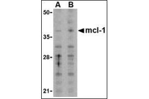 Western blot analysis of Mcl-1in Raji cell lysates with this product at (A) 1 and (B) 2 μg/ml. (MCL-1 Antikörper  (N-Term))