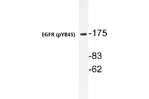 Western blot (WB) analyzes of p-EGFR antibody in extracts from A431 cells. (EGFR Antikörper  (pTyr869))