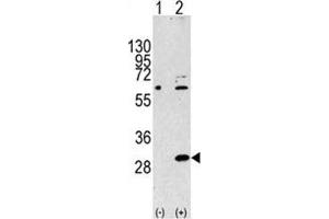 Western blot analysis of EIF4E2 antibody and 293 cell lysate either nontransfected (Lane 1) or transiently transfected with the EIF4E2 gene (2). (EIF4E2 Antikörper  (AA 12-41))